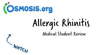 Allergic Rhinitis  Clinical Presentation [upl. by Blakeley410]