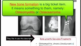 12DaysinMarch Podcast Series Osteomyelitis for the USMLE Step One Exam [upl. by Adnawad]