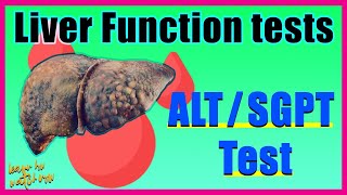 Alanine aminotransferase ALT test SGPT Alt test Results amp Interpretation  Liver function test [upl. by Noel140]