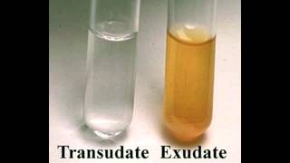 Transudate vs Exudate [upl. by Jahdai]