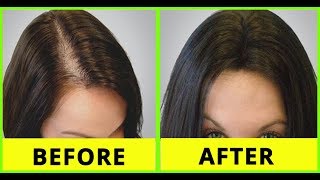 How to grow hair on forehead hair growth tips for forehead Tamil beauty tips [upl. by Yeneffit]