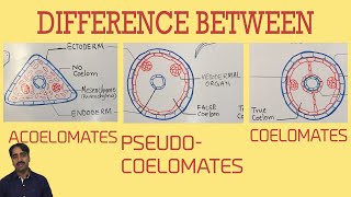 Acoelomates Pseudocoelomates and coelomates  Triploblastic organisation [upl. by Phaedra]