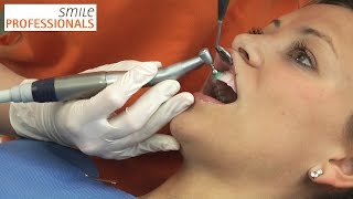 Professionelle Zahnreinigung  Zahnarzt Dr Seifert Aschaffenburg  Smile Professionals [upl. by Aehsel]