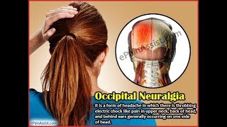 Greater occipital nerve block [upl. by Mcfadden]