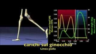 Analisi della deambulazione  carichi sul ginocchio [upl. by Llydnek13]