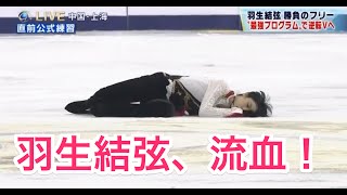 羽生結弦、流血！ 中国選手との衝突の瞬間！！ [upl. by Eerb]