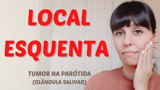 Esquenta o local  tumor na parótida [upl. by Ronaele]