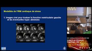 Conférence HEdS  L’imagerie cardiaque non invasive pour le diagnostic d’ischémie  LIRM [upl. by Edina]