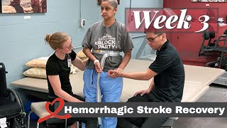 Hemorrhagic Stroke Recovery  Week 3 [upl. by Rahas]