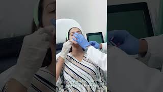 Tear Trough Correction  Dr Sarker Mahbub Ahmed Shamim  LaserTreat [upl. by Baxie]