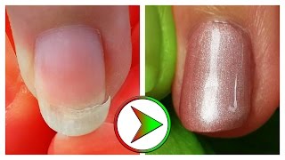 extrem eingebrochenen Nagel retten  Tutorial Nagelreparatur amp Reinigung [upl. by Deina346]