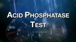 Acid Phosphatase Test [upl. by Sorenson]