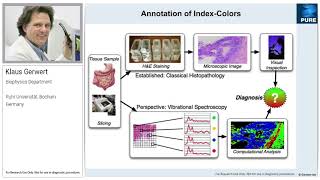 Labelfree FTIR imaging to distinguish malignant from nonmalignant tissues [upl. by Ynobe]