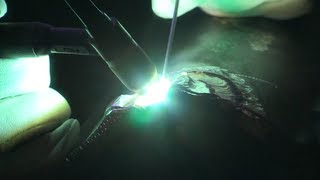 Tech Tips Welding Magnesium [upl. by Enerol897]