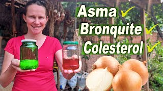 A CEBOLA trata o Colesterol Asma Bronquite Obesidade 🧅 4 Receitas para obter seus benefícios [upl. by Jarin]