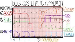 ECG Interpretation Made Easy Learn How to Interpret an ECG in 13 Minutes [upl. by Norling]