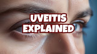 Anterior uveitis posterior uveitis and panuveitis etiology symptoms diagnosis and treatment [upl. by Ylle147]