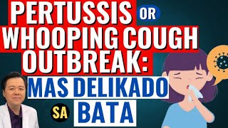 Pertussis or Whooping Cough Outbreak Mas Delikado sa Bata  Tips By Doc Willie Ong [upl. by Maltzman]