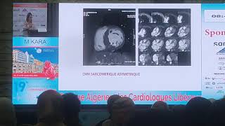 cardiomyopathie hypertrophique quelle stratégie diagnostic [upl. by Hsuk]