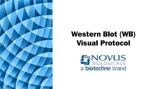 Western Blot WB Visual Protocol [upl. by Ely]