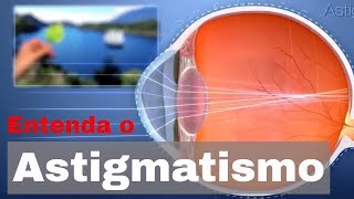 Entenda o astigmatismo [upl. by Eoin]