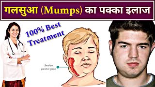 गलसुआ का बेस्ट ईलाज  Mumps treatment  symptoms  best medicine  mumps [upl. by Pinckney]