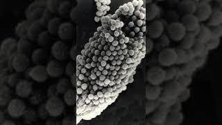 aspergillus species in microscopic view newsong love song viral remix music [upl. by Gnouh]