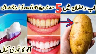 5 Natural Ways to Remove Tartar Buildup  teeth cleaning before and after [upl. by Michelsen227]