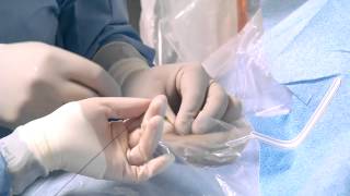 Transradial Cardiac Catheterization [upl. by Mistrot22]