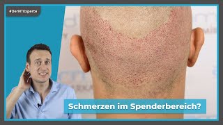 Schmerzen nach Haartransplantation  Heilungsverlauf amp Empfindlichkeit des Spenderbereichs [upl. by Laktasic647]