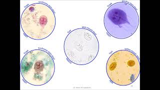 Giardia lamblia Giardia intestinalis Giardia doudenalis [upl. by Picker]