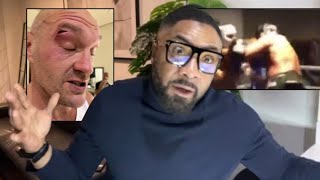 “IT WAS CLEARLY AN ELBOW” Spencer Fearon REVEALS SPARRING PARTNER WHO CUT TYSON FURY  USYK [upl. by Bromley]