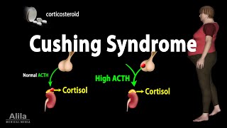 Cushing Syndrome Animation [upl. by Anilrahc]