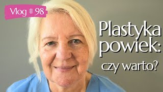 98 PLASTYKA POWIEK GÓRNYCH PRZED I PO moja opinia efekty i czy warto👁️✨ [upl. by Trimble]