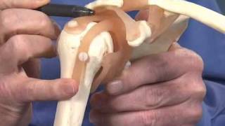 Shoulder Impingement  Dr Richard Hawkins [upl. by Nitsu]