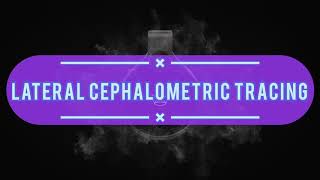 Lateral Cephalometric Tracing [upl. by Eeladnerb]