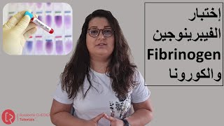 Fibrinogen test and Coronavirus  أختبار الفيبرينوجين والكورونا [upl. by Carli]