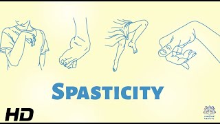 Spasticity The Hidden Challenge for Individuals with Disabilities [upl. by Elkin928]