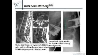 Video dynamische Stabilisierung [upl. by Adnuahs]