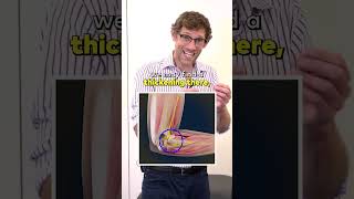 How to Check Your Elbow Pain [upl. by Stannwood]