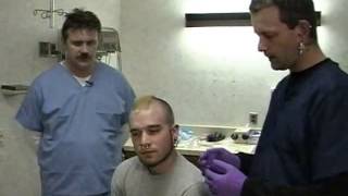 Body Piercing Removal in The Emergency Department  Excerpt from Bonus DVD [upl. by Rovelli]