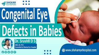 Congenital Eye Disease  Best Pediatric Eye Hospital in Bangalore  Shekar Eye Hospital [upl. by Donoghue]