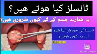 Tonsils Kia Hotay Hain ٹانسلز کا علاج ٹانسلز کی علامات [upl. by Nnylyak]