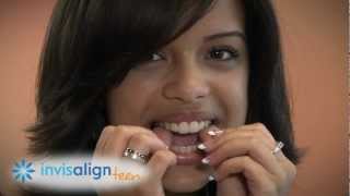 Invisalign and Invisalign Teen  How it Works and What to Expect [upl. by Zurc961]