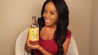 The Amazing Health Benefits of Apple Cider Vinegar [upl. by Albers358]