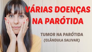 Várias doenças na parótida [upl. by Sarad]