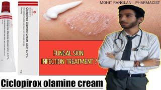 Ciclopirox olamine cream usp  Uses sideeffects directions  Fungal infection treatment in Hindi [upl. by Hanan]