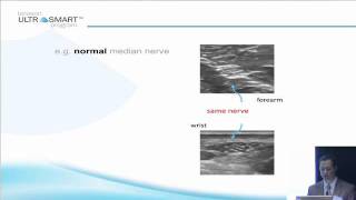 Terasons MSK Ultrasound Basics with Dr Visco Part 5 of 8 [upl. by Akitahs]