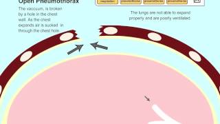 Understanding Pneumothorax in Dogs and Cats [upl. by Anatlus]