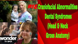 Craniofacial amp Dental Syndromes INBDE Dental Boards [upl. by Ennovaj]